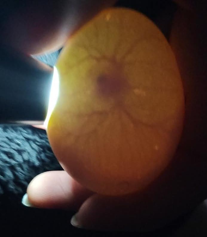 Egg Candler for Chicken Eggs, Rechargeable USB Egg Candling Light customer photo 2
